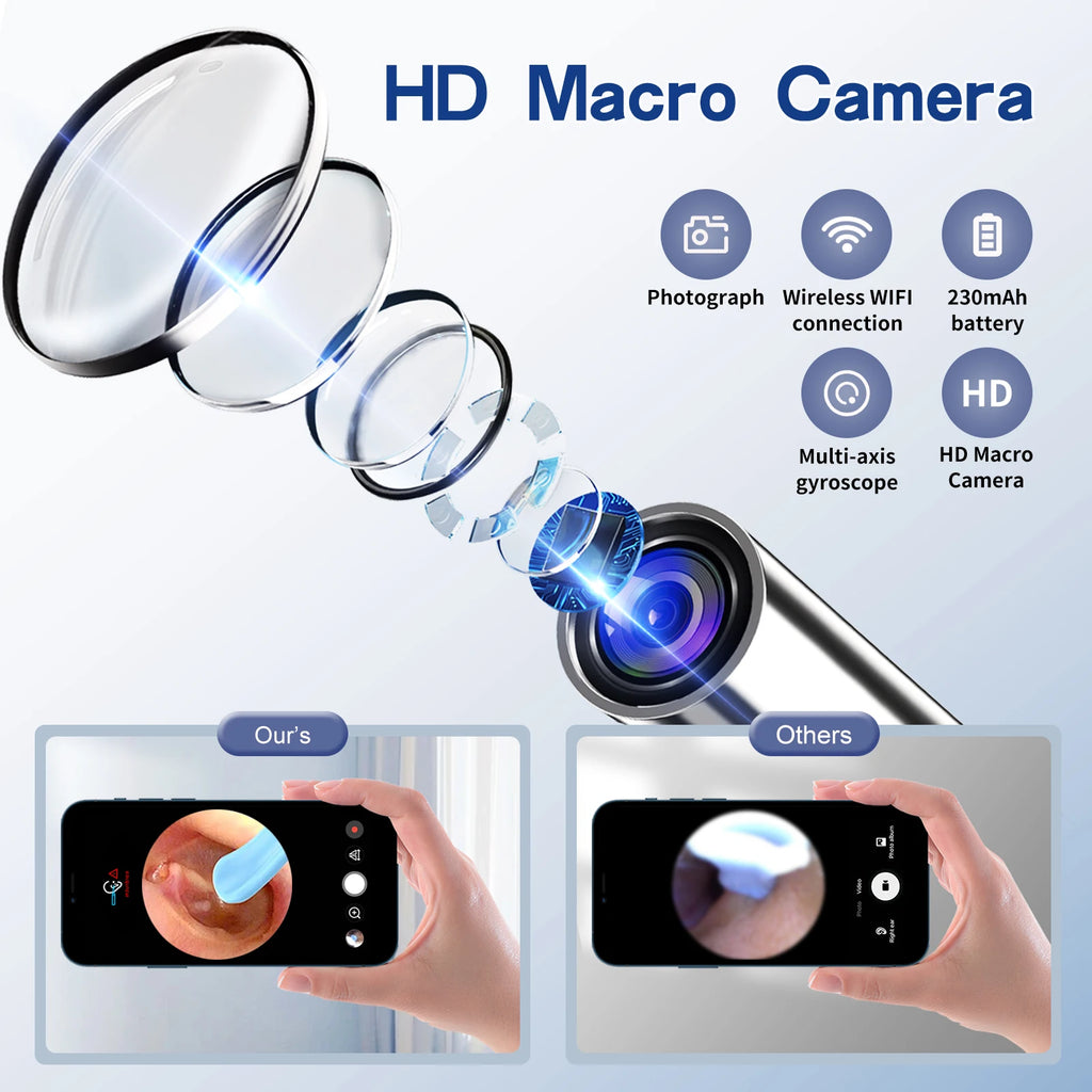 CC10 Smart Visual Ear Sticks Otoscope 1296P HD Endoscope Wax Removal Tool Earpick With Mini Camera