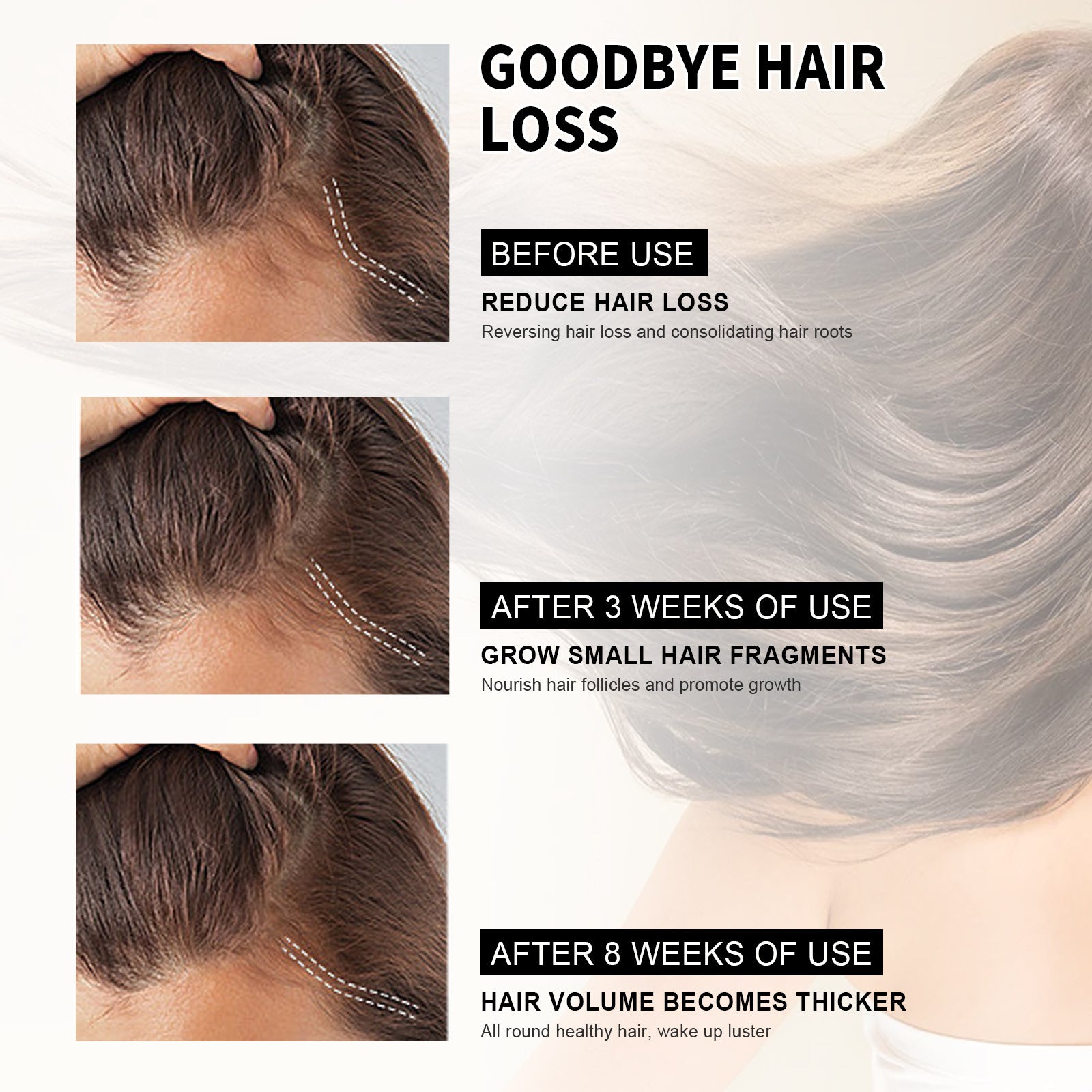 Hair Loss Treatment Shampoo Anti-itch Anti Dandruff Oil Control Hair Growth Serum Oil Scalp Root Thicker Fast Regrowth Essence