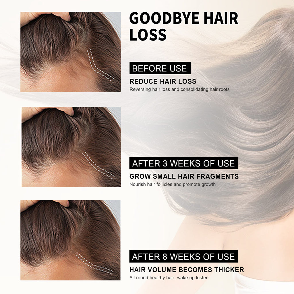 Hair Loss Treatment Shampoo Anti-itch Anti Dandruff Oil Control Hair Growth Serum Oil Scalp Root Thicker Fast Regrowth Essence