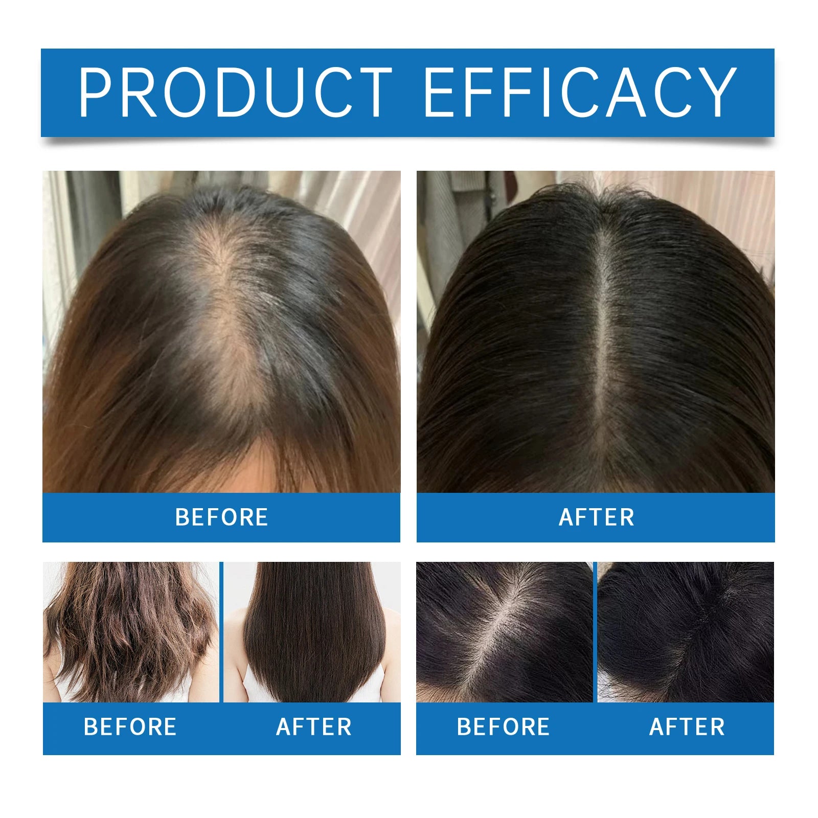 Rosemary Hair Serum Relax Scalp Stimulate Follicles Promote Hair Growth Roller Frizzy Split Ends Damaged Hair Repair Essence Oil