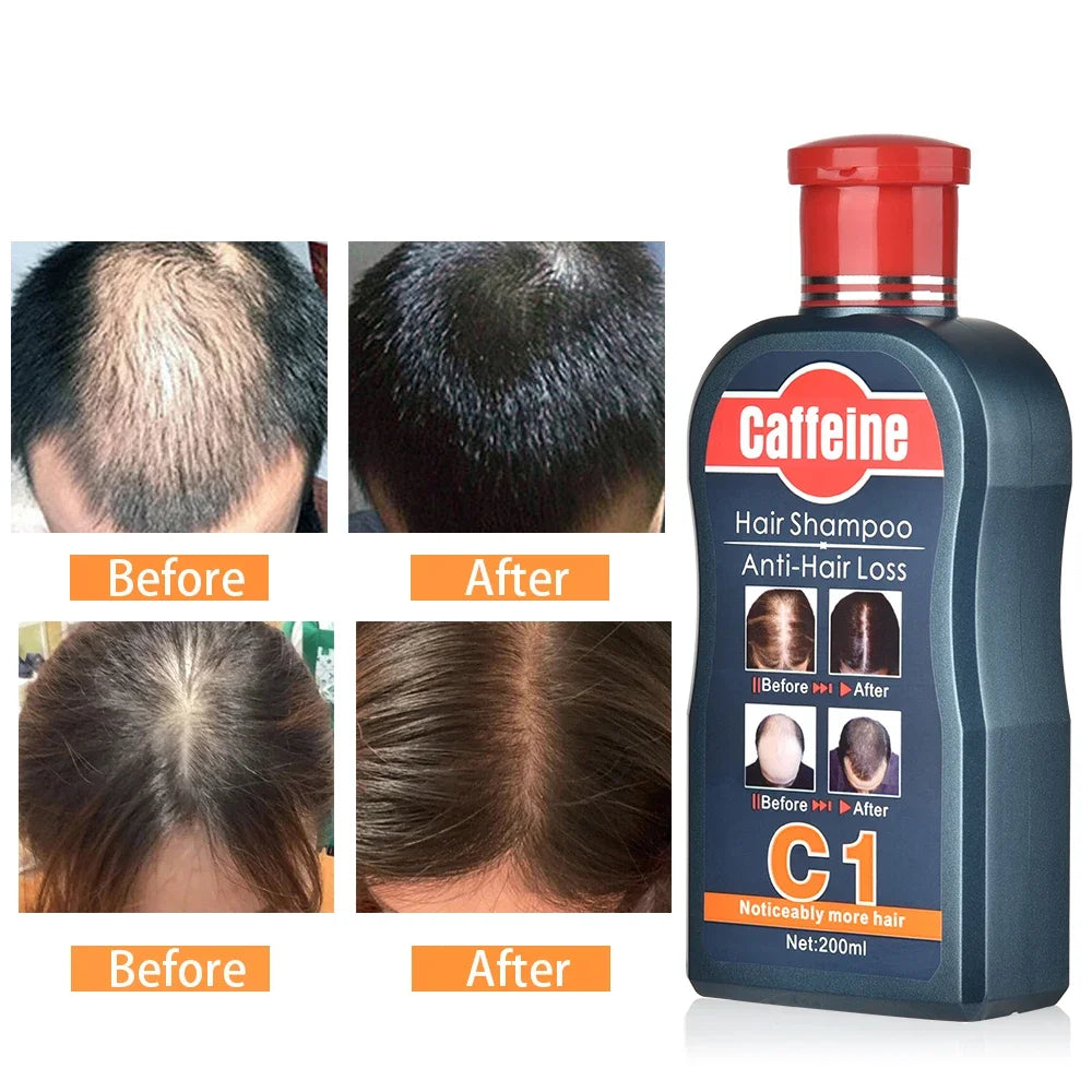 Men Shampoo For Hair Growth Natural Plants Caffeine Anti Hair Loss Dandruff Nourish Care Treatment Shampoo 200ML Hair care