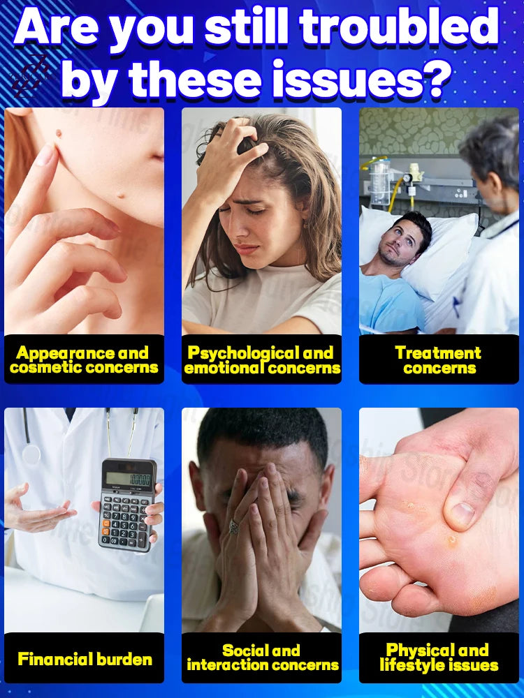 2025's best-selling ʷᵃʳᵗ ʳᵉᵐᵒᵛᵃˡ ᵖᵉⁿ!ᴾᵃⁱⁿˡᵉˢˢ ʷᵃʳᵗ ʳᵉᵐᵒᵛᵃˡ, with an amazing repurchase rate