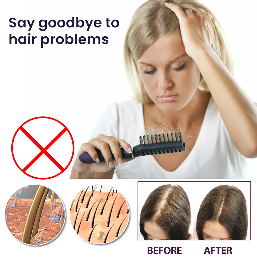 Fast Hair Growth Spray Products Anti Hair Loss Serum Prevent Baldness Treatment Scalp Dry Damaged Essential Oil Hair Beauty 50ml