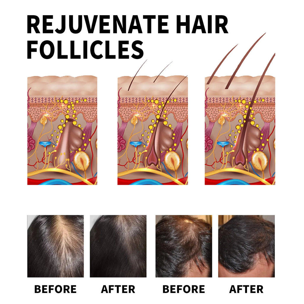Hair Loss Treatment Shampoo Anti-itch Anti Dandruff Oil Control Hair Growth Serum Oil Scalp Root Thicker Fast Regrowth Essence