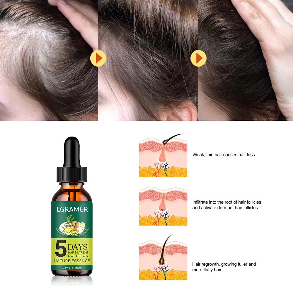 Ginger Natural Plant Hair Care Essential Oil Hair Growth Liquid Anti Hair Loss Nourish Scalp Dry Nourish Hair Treatment Product