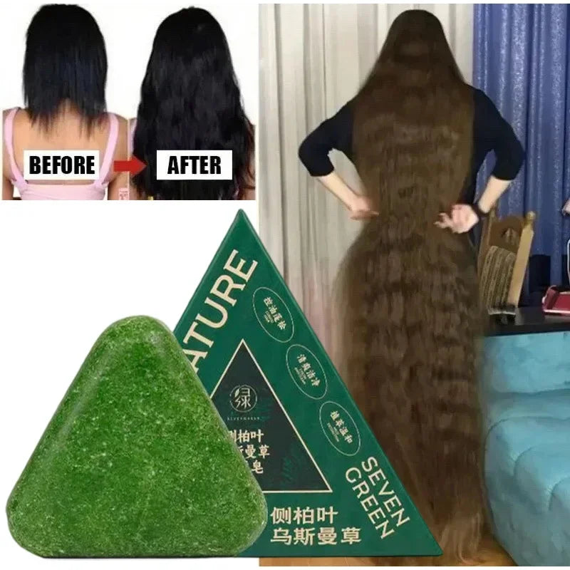 Usman Grass & Platycladus Shampoo Bar For Hair Growth Natural Herbal Soap For Hair Loss Controls Oil Strengthens Roots Shampoo