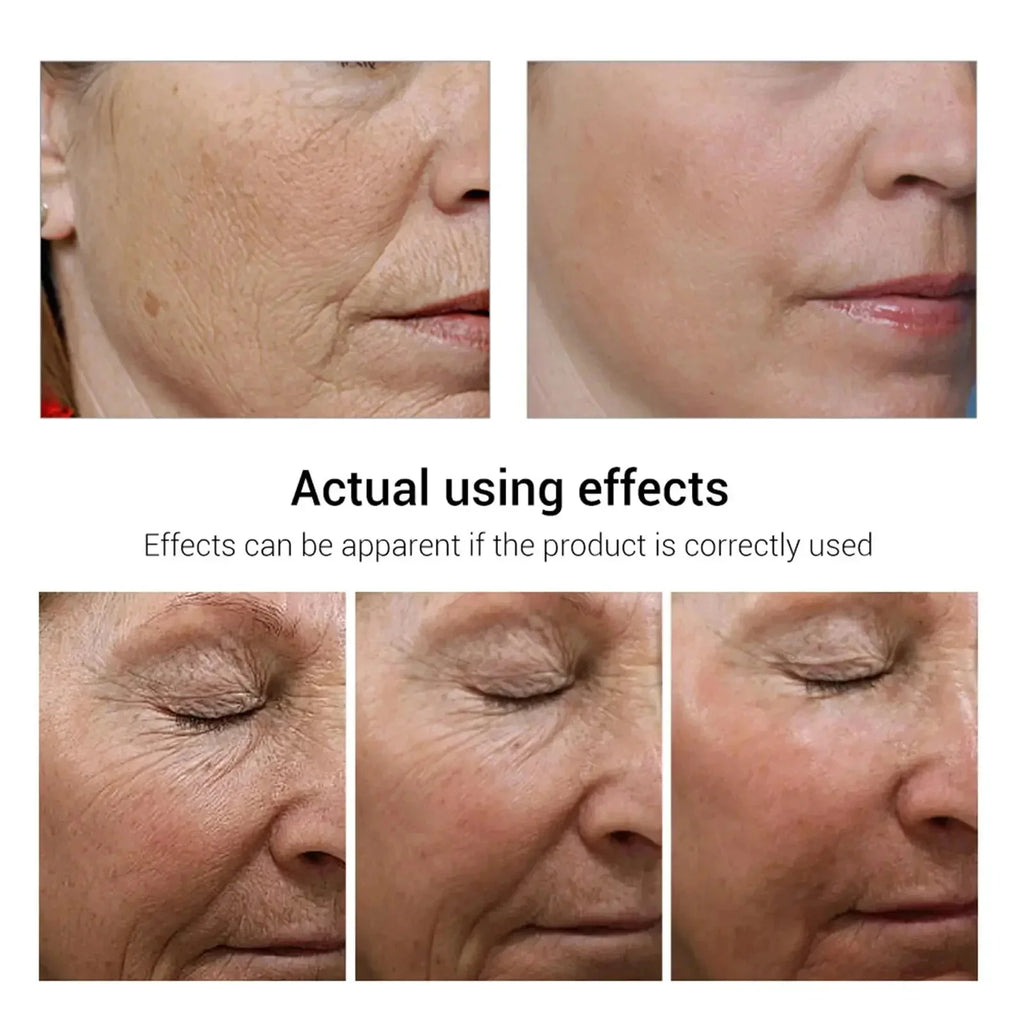 Retinol Wrinkle Removal Facial Kit Instant Firming Enhancement Anti Aging Serum Fading Fine Line Whitening Korean Skincare