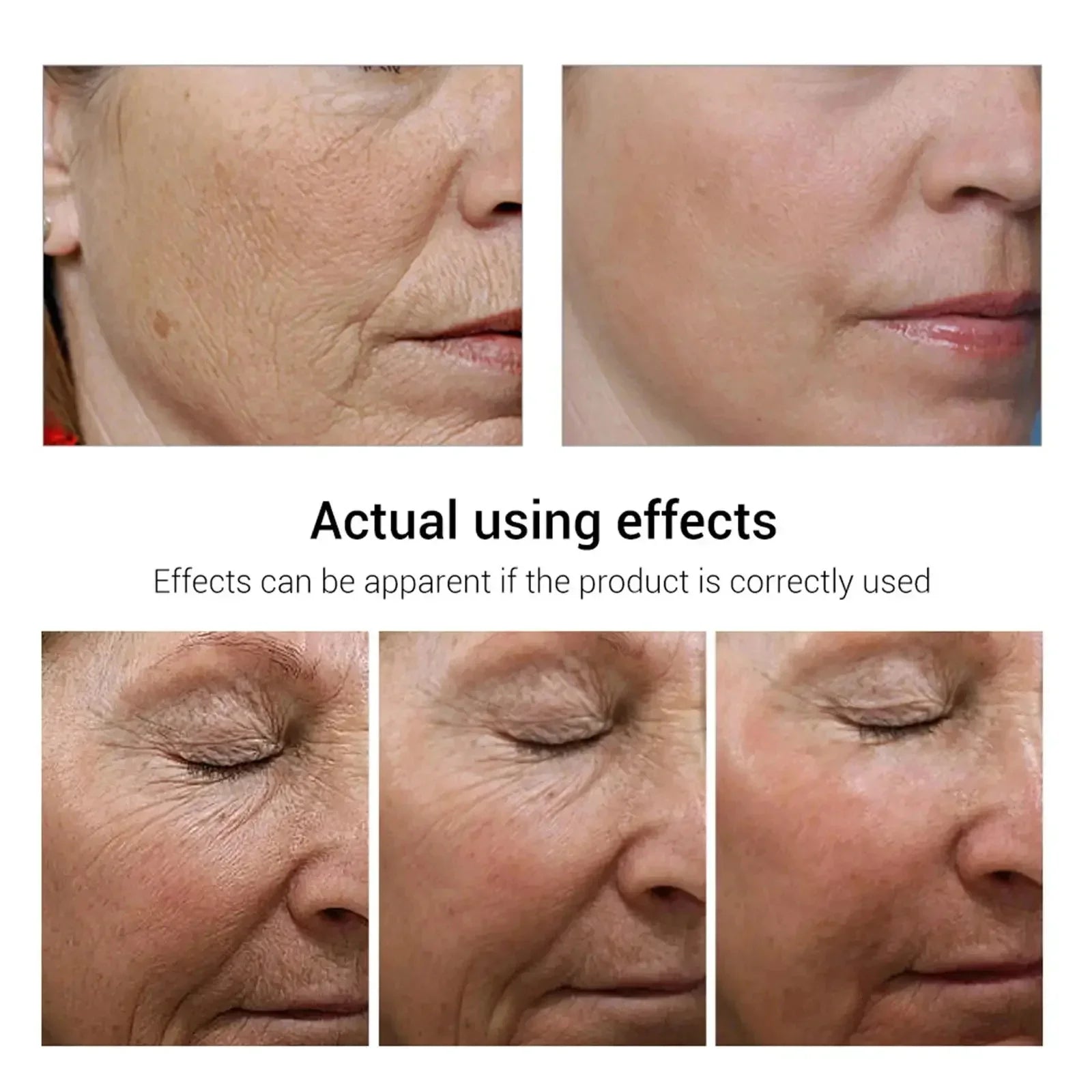 Retinol Wrinkle Removal Facial Kit Instant Firming Enhancement Anti Aging Serum Fading Fine Line Whitening Korean Skincare
