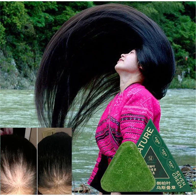 Usman Grass & Platycladus Shampoo Bar For Hair Growth Natural Herbal Soap For Hair Loss Controls Oil Strengthens Roots Shampoo