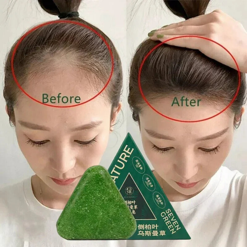 Usman Grass & Platycladus Shampoo Bar For Hair Growth Natural Herbal Soap For Hair Loss Controls Oil Strengthens Roots Shampoo