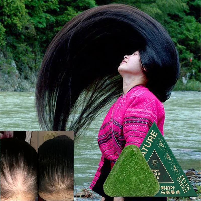 Usman Grass & Platycladus Shampoo Bar For Hair Growth Natural Herbal Soap For Hair Loss Controls Oil Strengthens Roots Shampoo