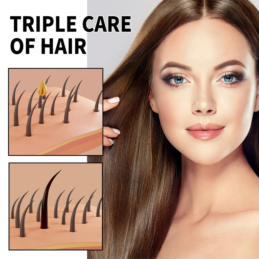 Hair Loss Treatment Shampoo Anti-itch Anti Dandruff Oil Control Hair Growth Serum Oil Scalp Root Thicker Fast Regrowth Essence