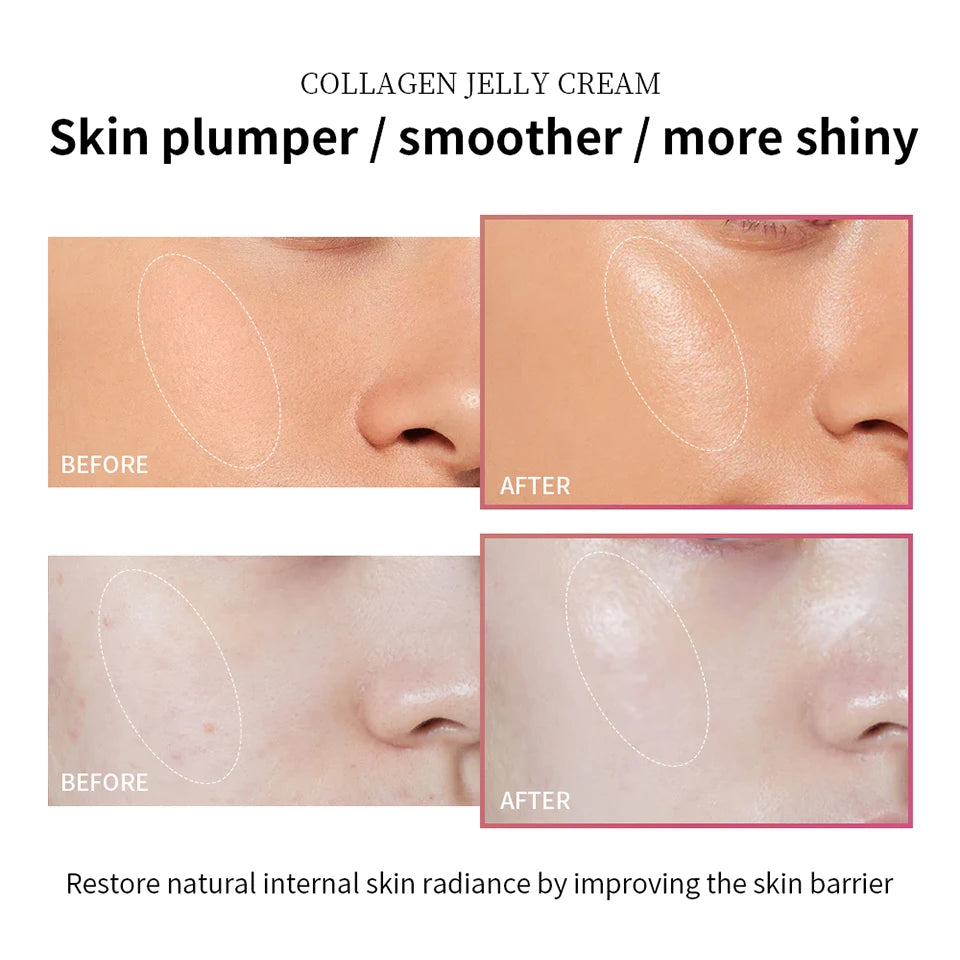 Anti Aging Collagen Face Cream 100ml Niacinamide Moisturizer Hydrating Gel For Tightening Soothing Firmness Skincare