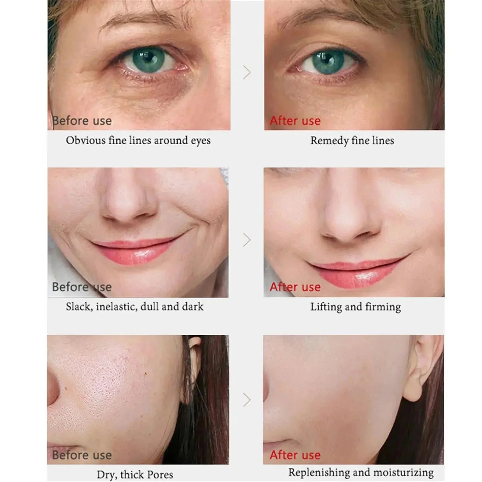 Retinol Wrinkle Removal Facial Kit Instant Firming Enhancement Anti Aging Serum Fading Fine Line Whitening Korean Skincare
