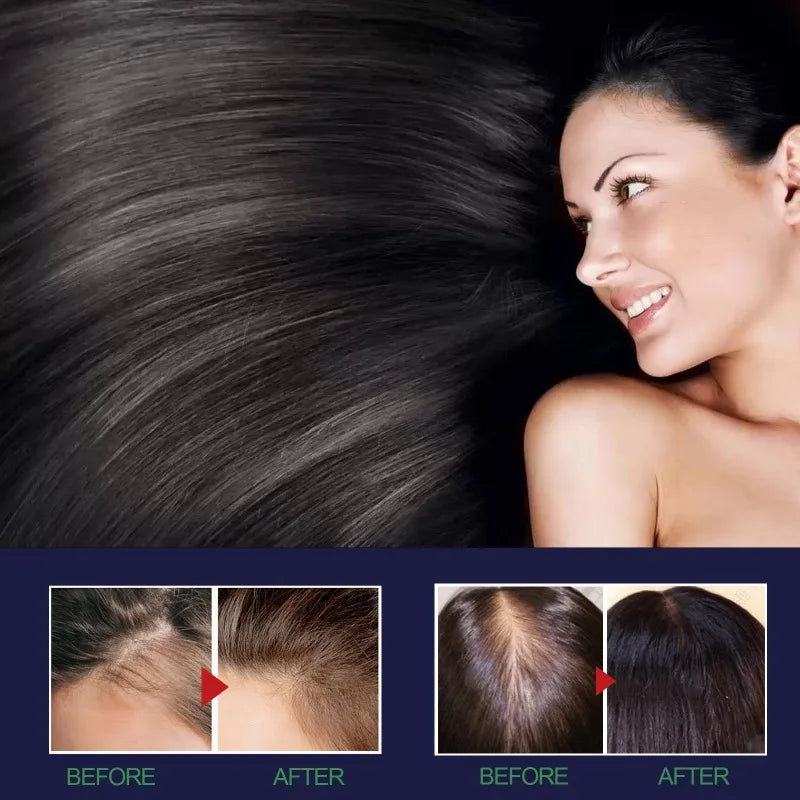 Fast Hair Growth Spray Products Anti Hair Loss Serum Prevent Baldness Treatment Scalp Dry Damaged Essential Oil Hair Beauty 50ml