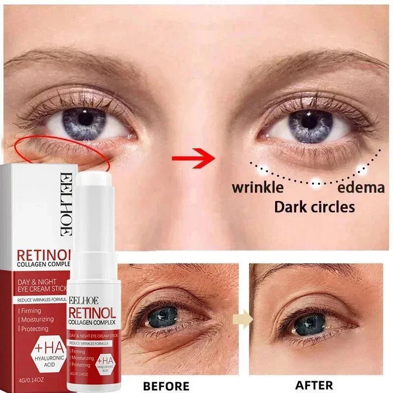 Retinol Wrinkle Removal Facial Kit Instant Firming Enhancement Anti Aging Serum Fading Fine Line Whitening Korean Skincare