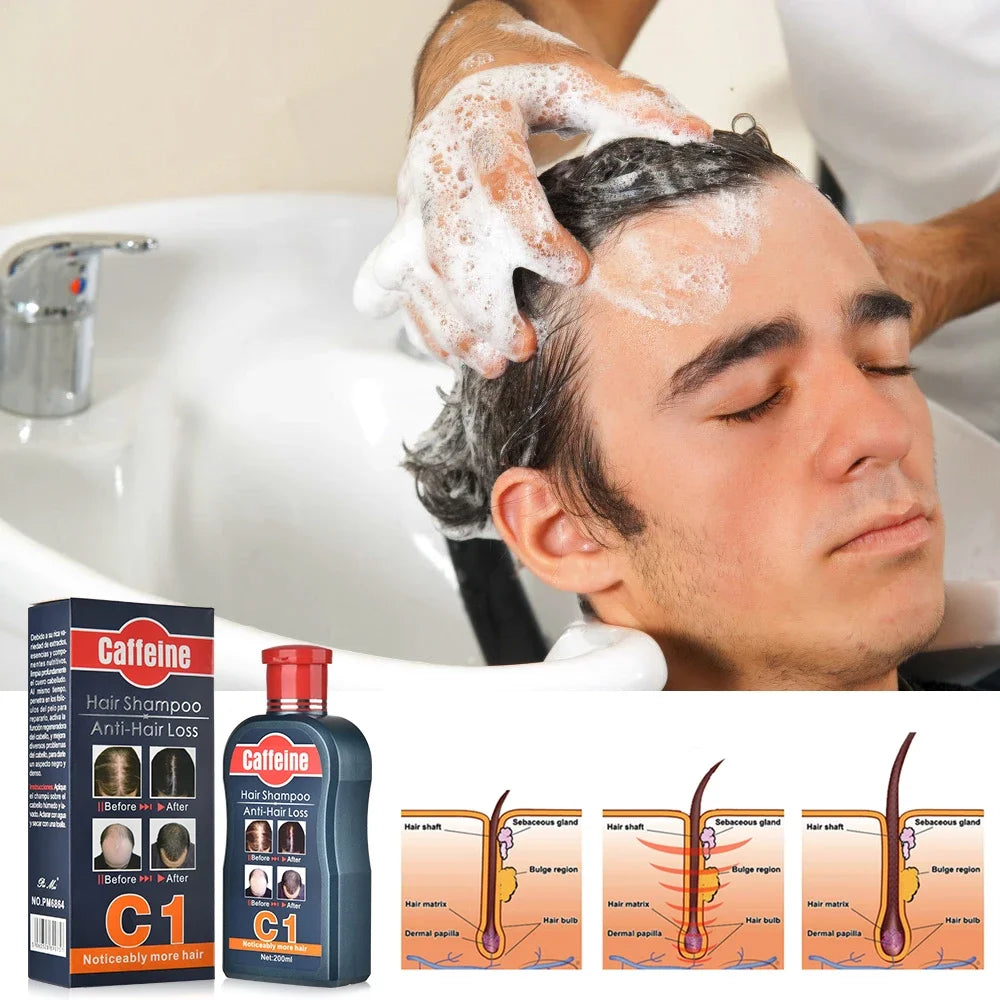 Men Shampoo For Hair Growth Natural Plants Caffeine Anti Hair Loss Dandruff Nourish Care Treatment Shampoo 200ML Hair care