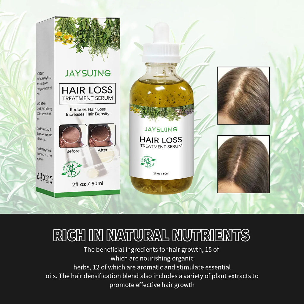 Hair Loss Treatment Shampoo Anti-itch Anti Dandruff Oil Control Hair Growth Serum Oil Scalp Root Thicker Fast Regrowth Essence