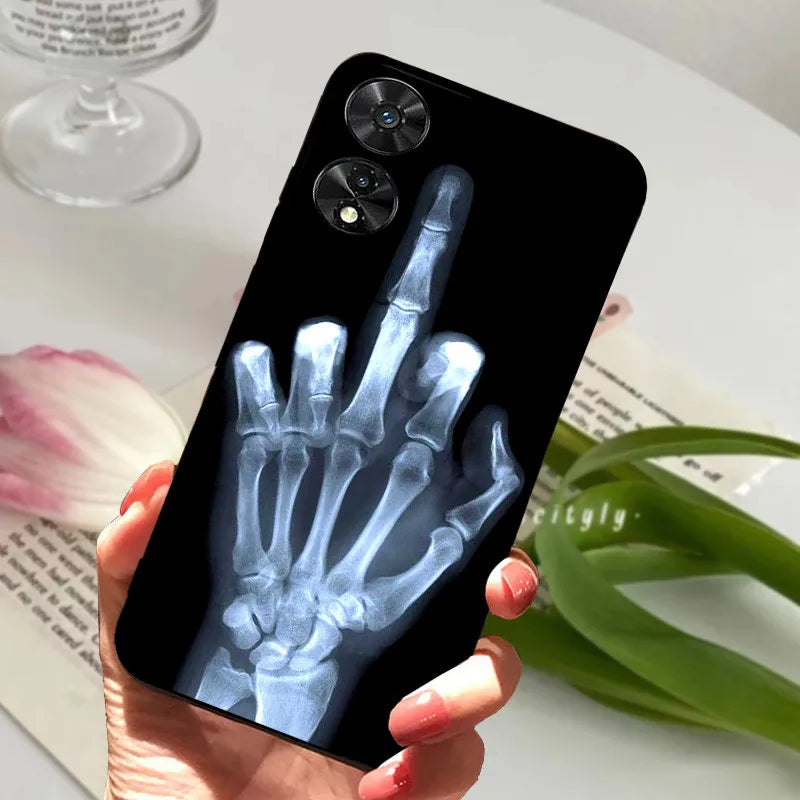 For TCL 505 Case TCL 50 SE / 50 5G Silicone Shockproof Soft Phone Cover for TCL 505 Case Funda Cute TPU Coque Protective Shell