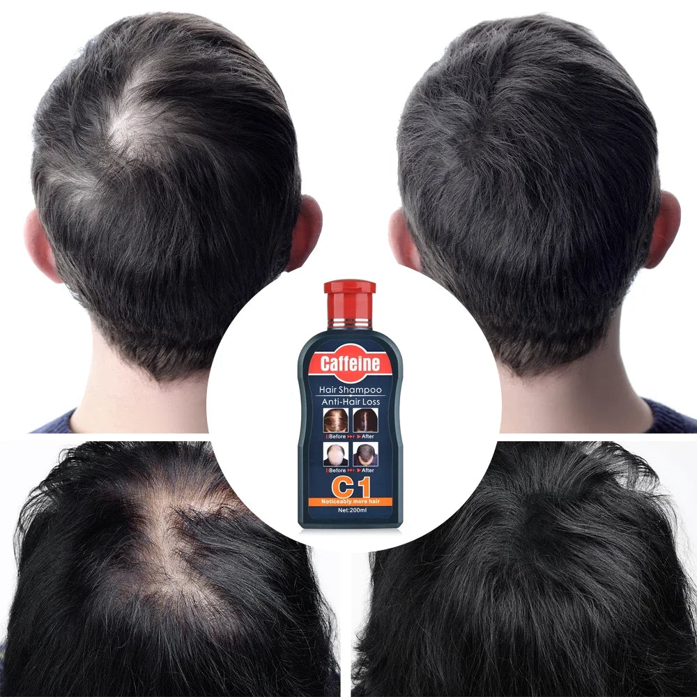 Men Shampoo For Hair Growth Natural Plants Caffeine Anti Hair Loss Dandruff Nourish Care Treatment Shampoo 200ML Hair care