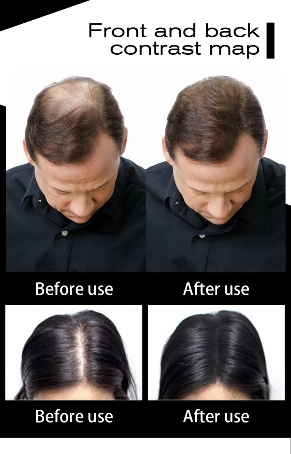 Sevich 10 Colors Hair Fiber 50g Hair Building Fiber Powder Keratin Instant Hair Growth Fiber Refill Hair Loss Hair Care Product